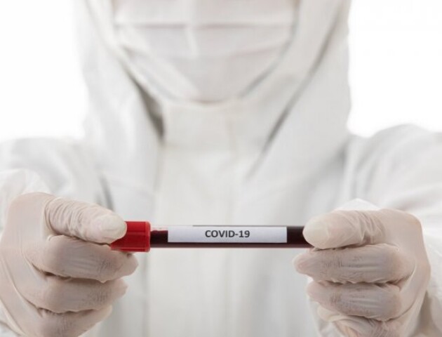 На Волині 356 нових заражень коронавірусом. Ще 5 людей померло