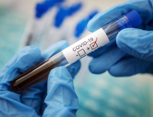 На Волині виявили 467 нових хворих на коронавірус