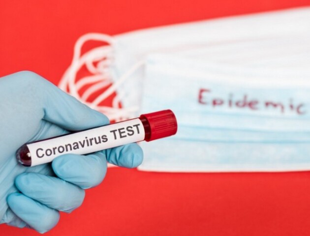 В Україні коронавірус підтвердили ще у 706 людей. Одужало лише 88 осіб