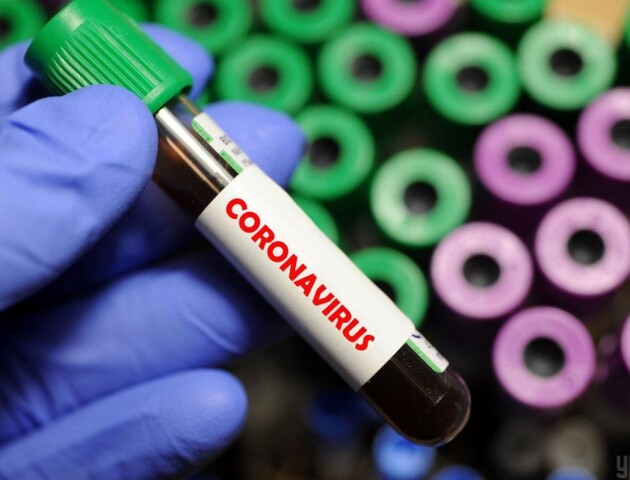 В Україні 548 хворих на коронавірус. 13 людей померли, 8 - одужали