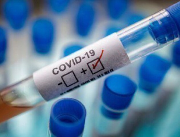 На Волині зафіксували 29 нових хворих на коронавірус. У Луцьку - 5