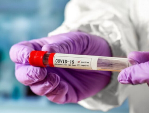 На Волині виявили 70 нових хворих на коронавірус. Найбільше – у Ратнівському районі