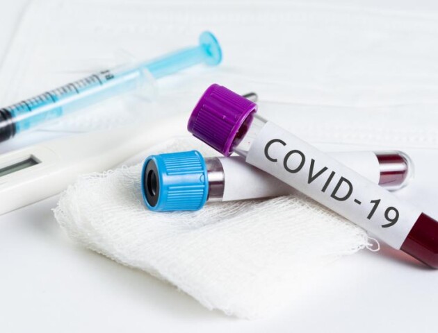 На Волині за добу 92 нових хворих на коронавірус та чотири смерті