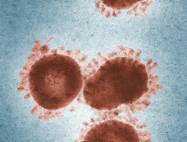 Число заражень коронавірусом на Волині теж зростає