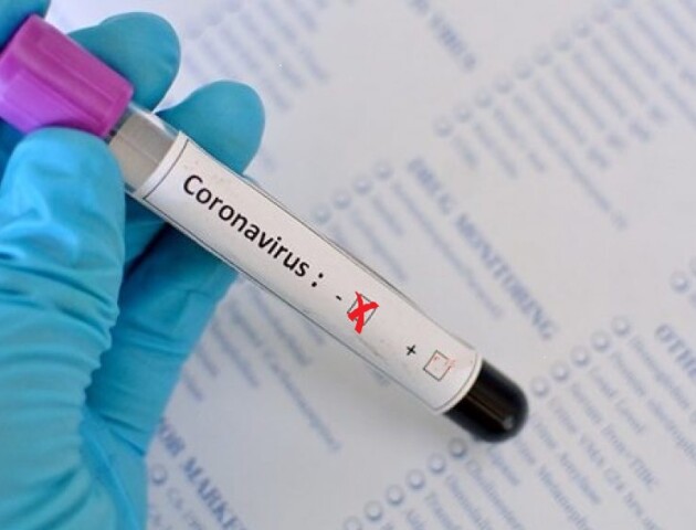 У священника і паламаря, які відспівували інфікованого лікаря, коронавірусу не виявили