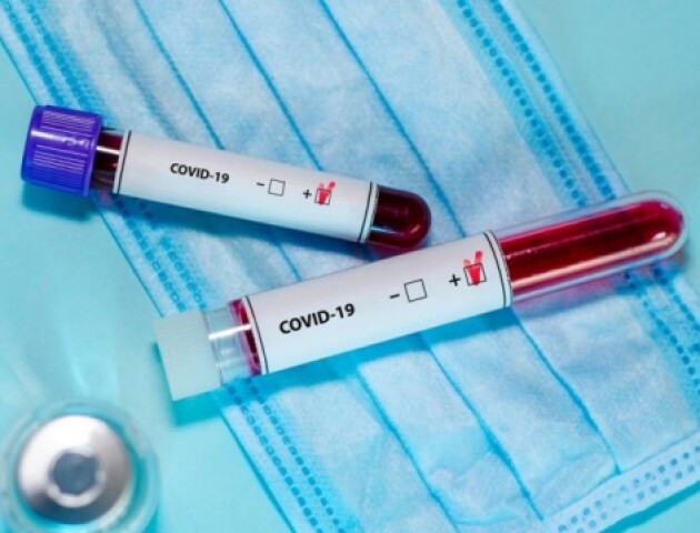 На Волині виявили 313 нових хворих на коронавірус, одна людина померла