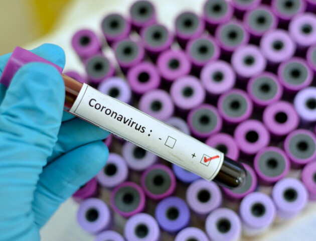 В Україну прибули системи для тестування на новий коронавірус – МОЗ