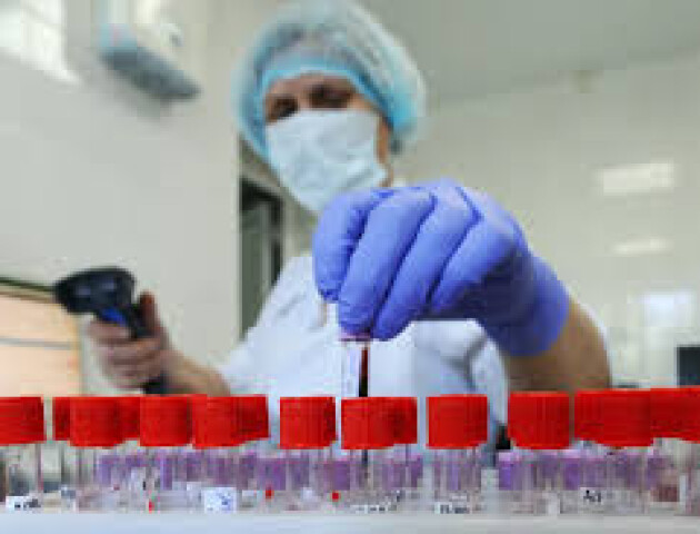 У Луцьку зафіксували 9 нових випадків коронавірусу
