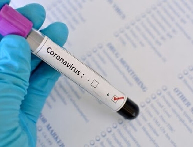 У Луцьку 28 підтверджених випадків коронавірусу