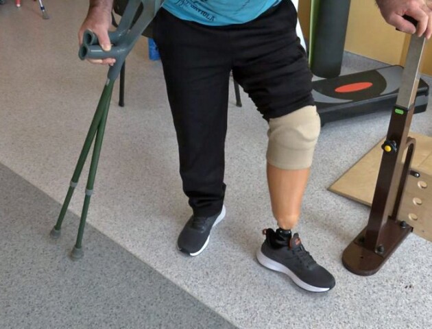 Знову вчиться ходити: пораненому бійцю з Волині луцькі лікарі встановили протез