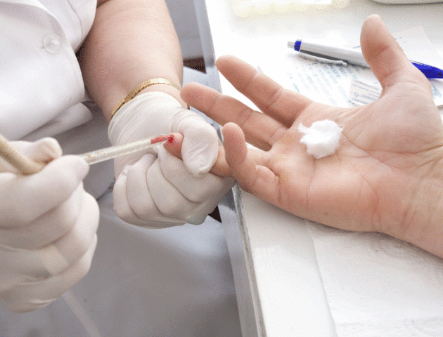 У Луцьку під час безкоштовного тестування у восьми людей виявили гепатит С