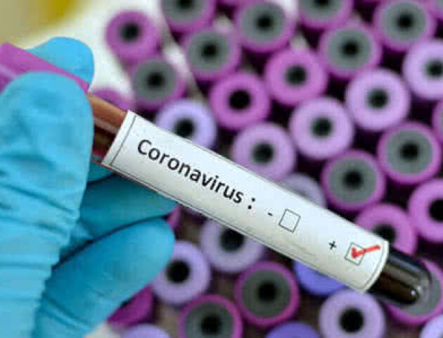В Україні 794 підтверджених хворих на коронавірус