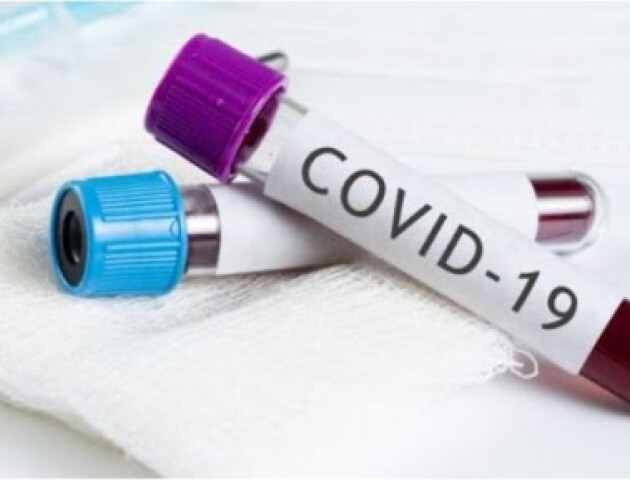 На Волині виявили 70 нових хворих на COVID-19. Де саме?