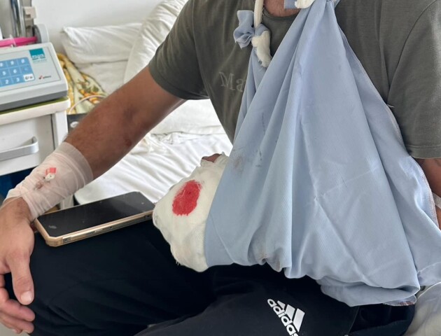 Травмувався на будівництві: хірурги пришили руку 37-річному волинянину