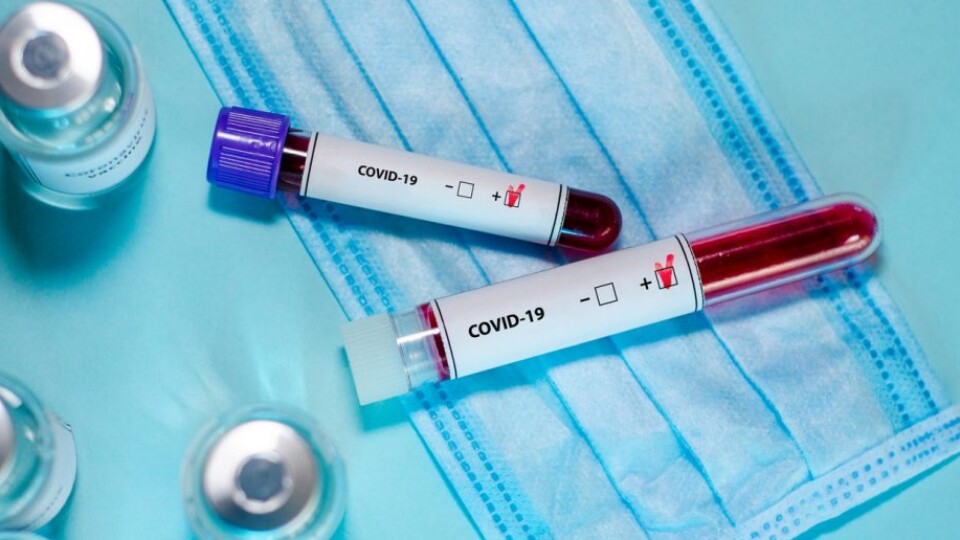 Скільки нових хворих на коронавірус виявили в Україні