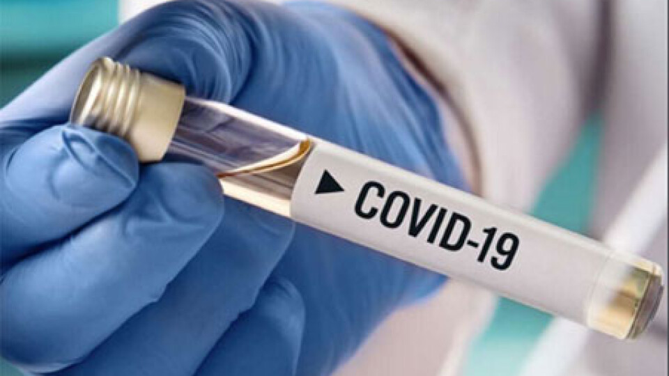 На Волині у ще 77 людей виявили коронавірус