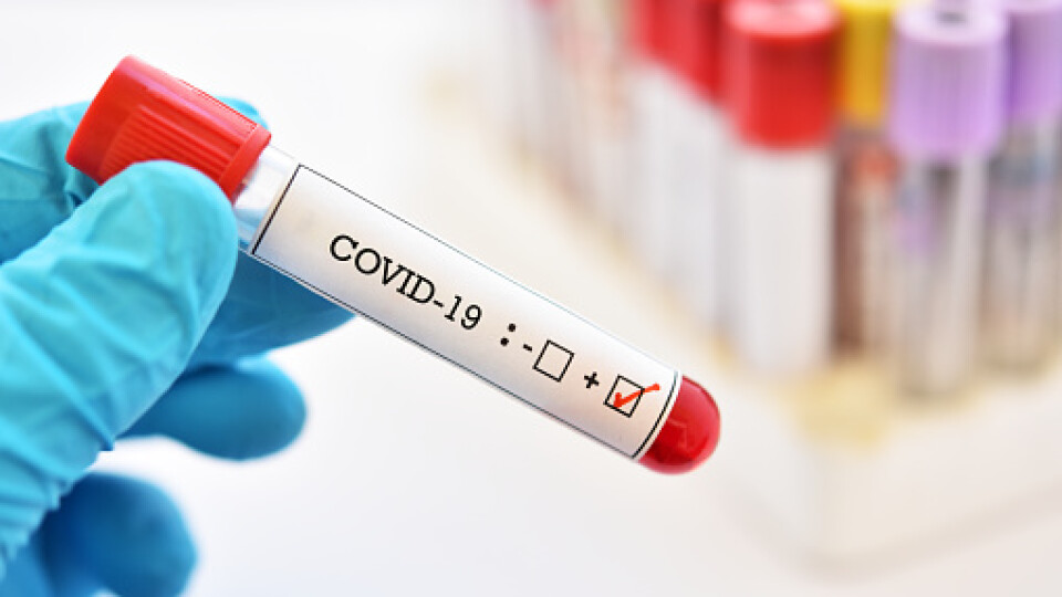 На Волині за минулу добу виявили 129 хворих на COVID-19. Скільки у Луцьку?