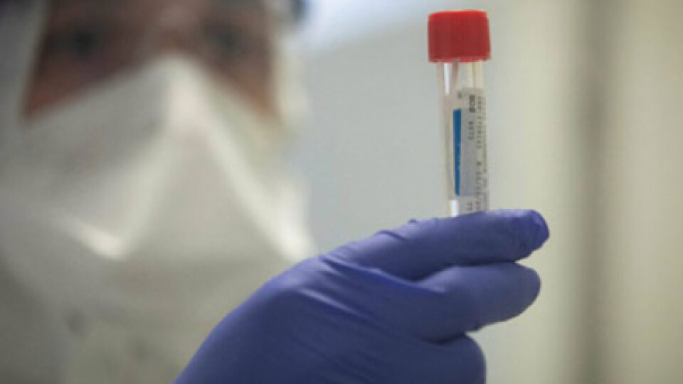 У Житомирі підтвердили перший випадок коронавірусу