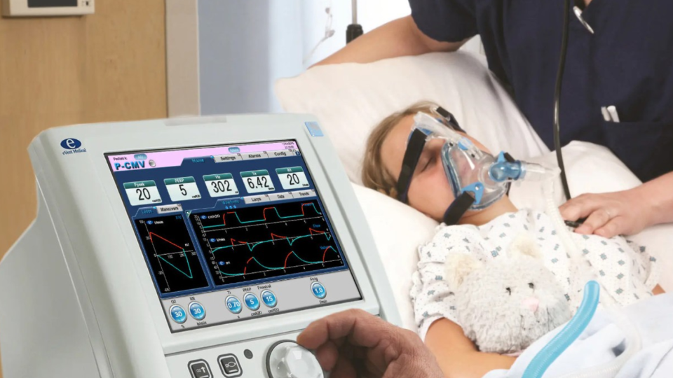 Адаптація апаратів ШВЛ для дітей: що враховувати під час вибору педіатричного обладнання