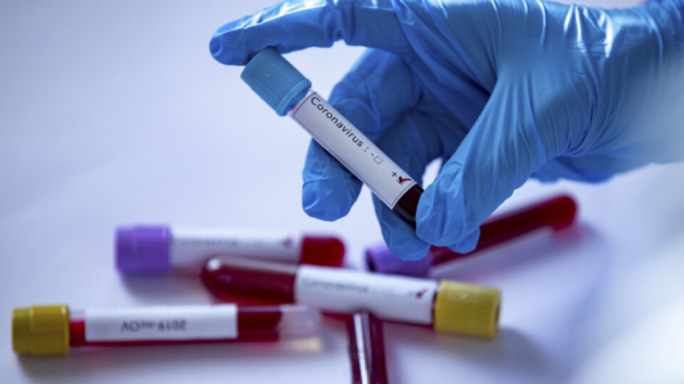 У США затвердили новий тест, який одночасно виявляє грип та коронавірус
