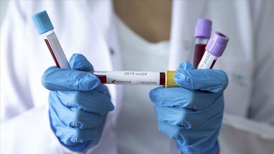 Коронавірус на Волині: 555 нових хворих та 13 смертей