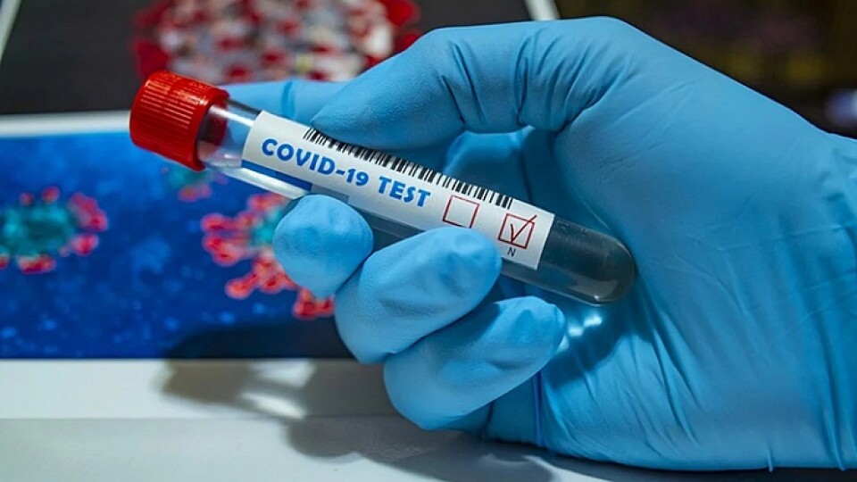 За минулу добу коронавірус виявили у 628 волинян