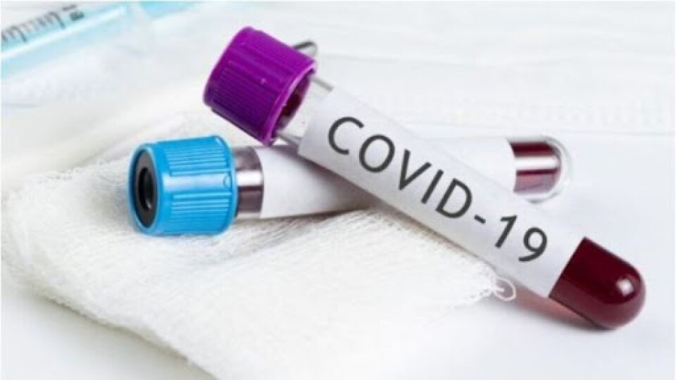 Новий антирекорд: за добу коронавірус діагностували у майже 700 українців