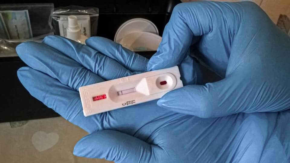 У луцькій лікарні на коронавірус тестують методом ІФА