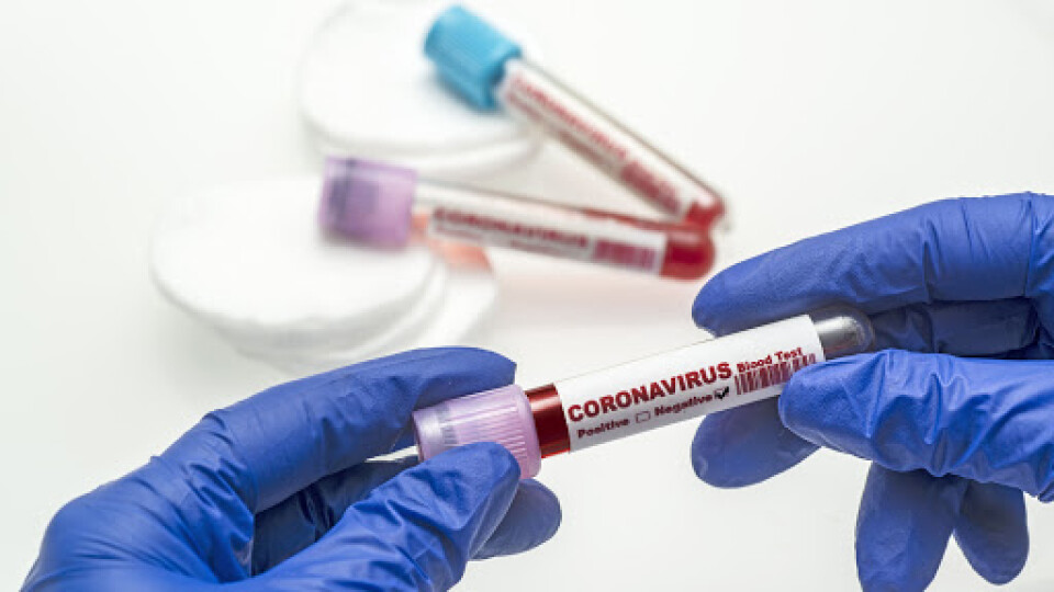 На Волині за минулу добу виявили 2 хворих на коронавірус