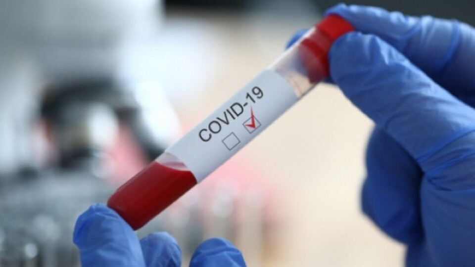 За минулу добу коронавірус виявили у 56 волинян. Найбільше – у Луцьку