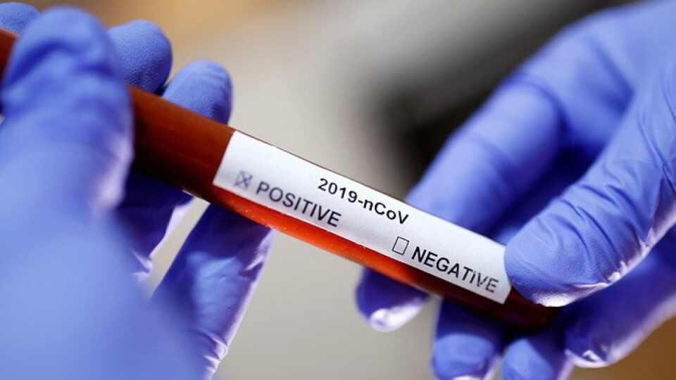 На Волині лабораторно підтвердили перший випадок коронавірусу, – ДСНС
