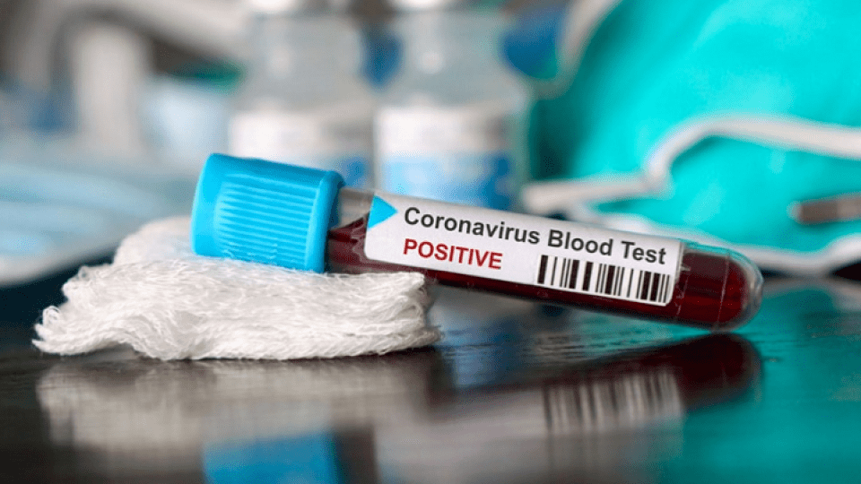 В Україні за добу виявили 7 709  хворих на коронавірус. Одужало — 5 145