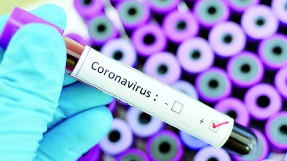 Коронавірус міг поширитися з наукової лабораторії, – учені