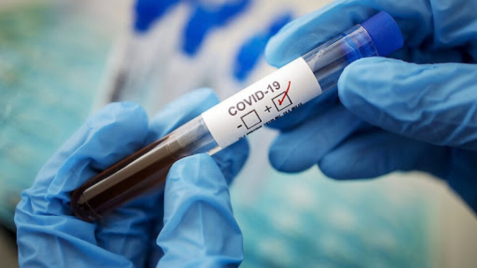За добу у 37 волинян виявили коронавірус. Розказуємо, де