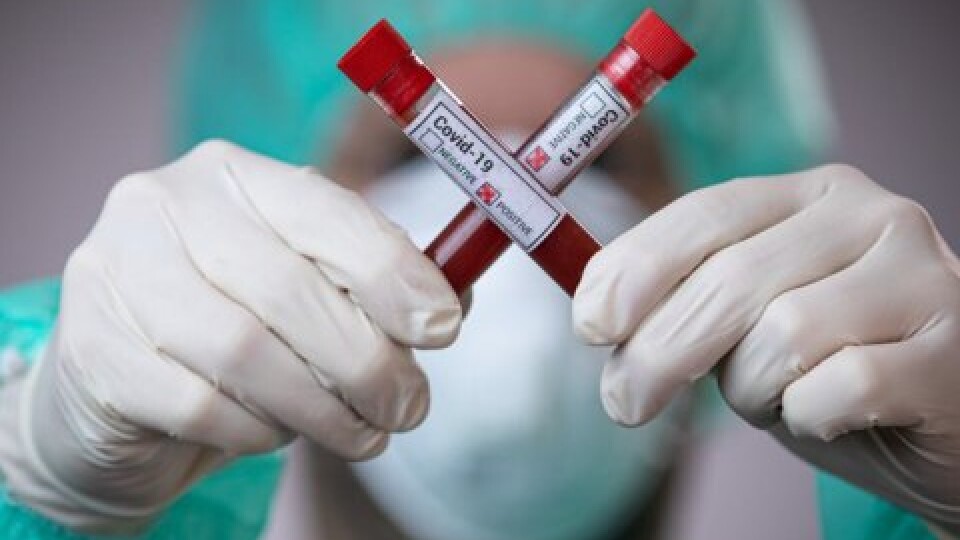 В Україні за добу виявили 12 498 хворих на коронавірус