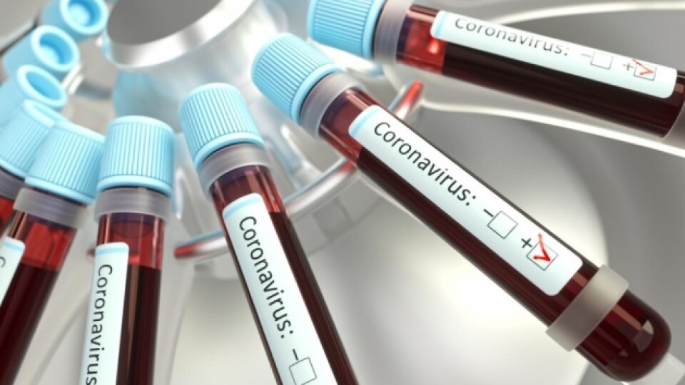 У більшості хворих на коронавірус, які померли в Україні, був цукровий діабет, – МОЗ