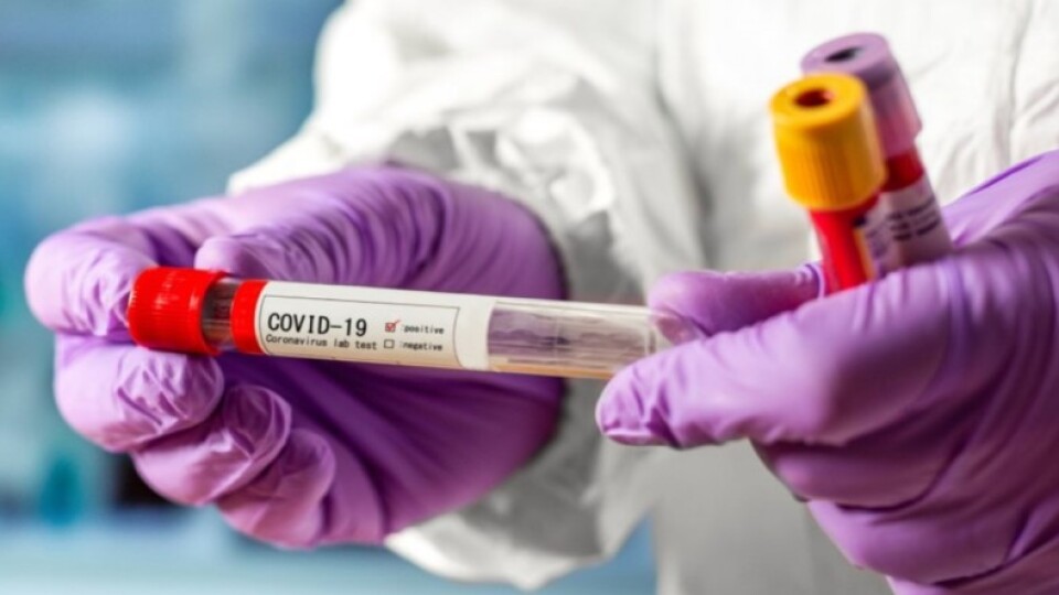 В Україні за минулу добу виявили 916 хворих на коронавірус