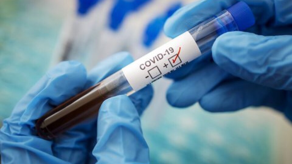 В Україні за добу виявили 5 159 хворих на коронавірус