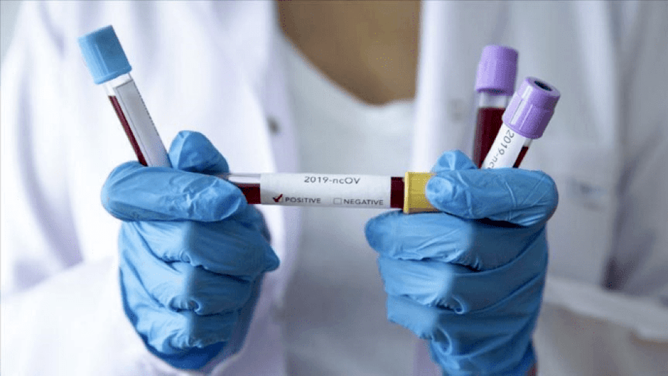 За добу в Україні 351 людина померла від коронавірусу