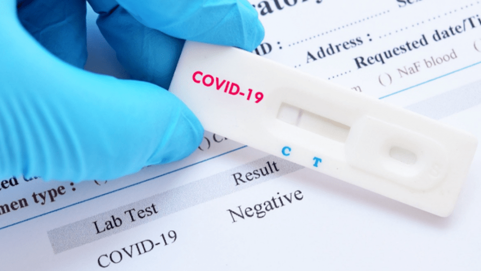 У МОЗ розповіли, кого тестуватування на антитіла до COVID-19