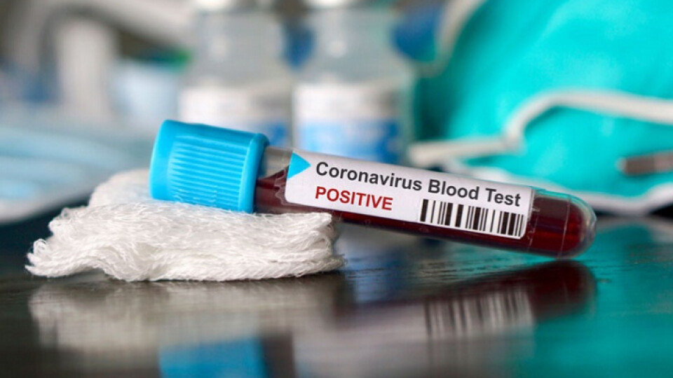 В Україні за добу виявили майже 19 тисяч хворих на коронавірус