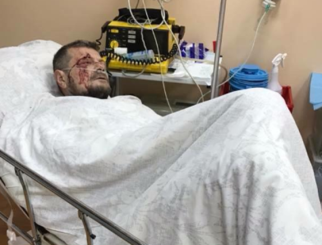 Лікарі про Мосійчука: Стан важкий, чекає на нову операцію