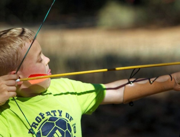 На Волині 8-річна дитина травмувала око стрілою з лука
