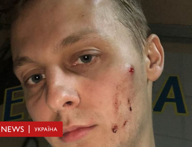 Сина депутата Шуфрича побили працівники «органів»